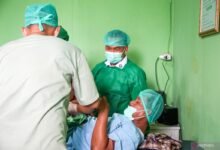 BEGINI CARA KERJA DAN PROSEDUR KONTRASEPSI VASEKTOMI PADA PRIA  IMG 20250422 WA0023 EDIT 910458577403258